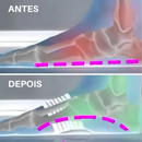 Faixa de Suporte para Arco do Pé Pedivit | Alívio imediato da dor