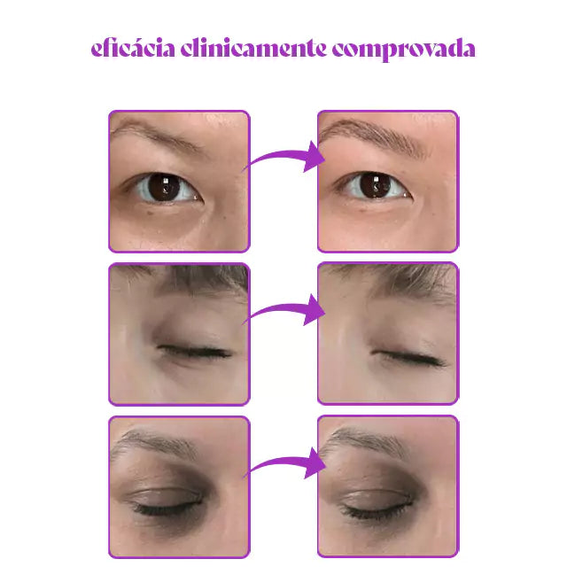Corretor de Olheiras Luminous | Clareia e revitaliza a região dos olhos