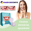 Facetas Dentárias Naturais Removíveis PerfetctSmile One | Seu sorriso perfeito em poucos minutos