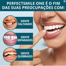 Facetas Dentárias Naturais Removíveis PerfetctSmile One | Seu sorriso perfeito em poucos minutos