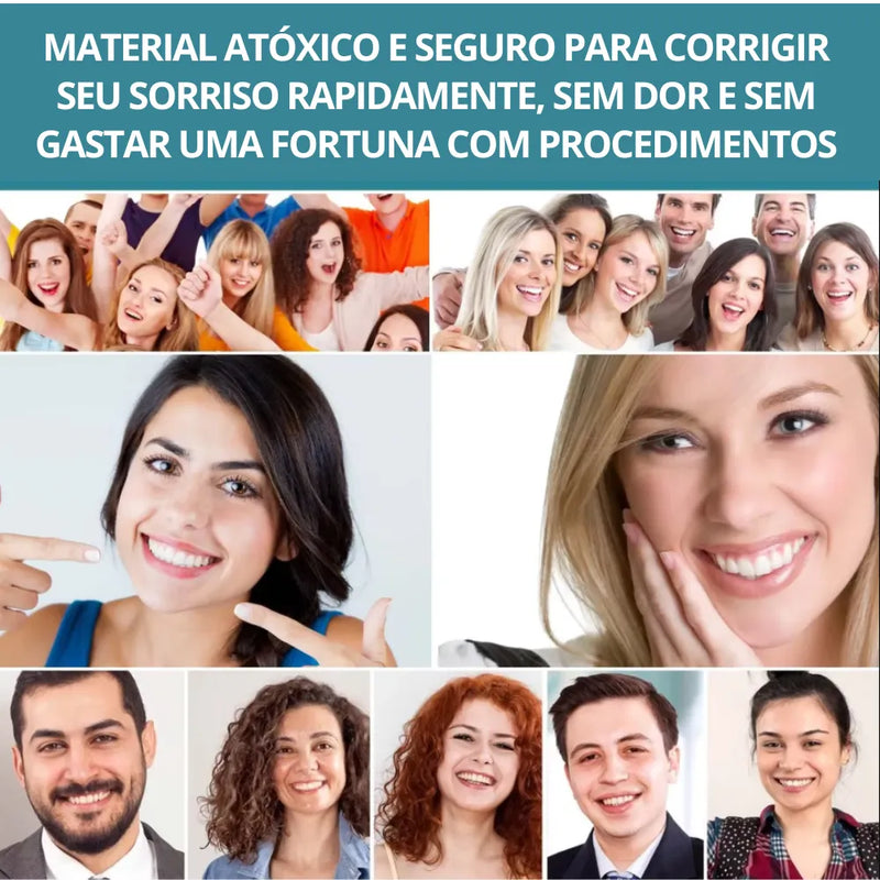 Facetas Dentárias Naturais Removíveis PerfetctSmile One | Seu sorriso perfeito em poucos minutos