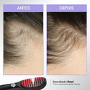 Escova de Terapia Capilar TheraBrush | Reduz a queda de cabelo e caspa